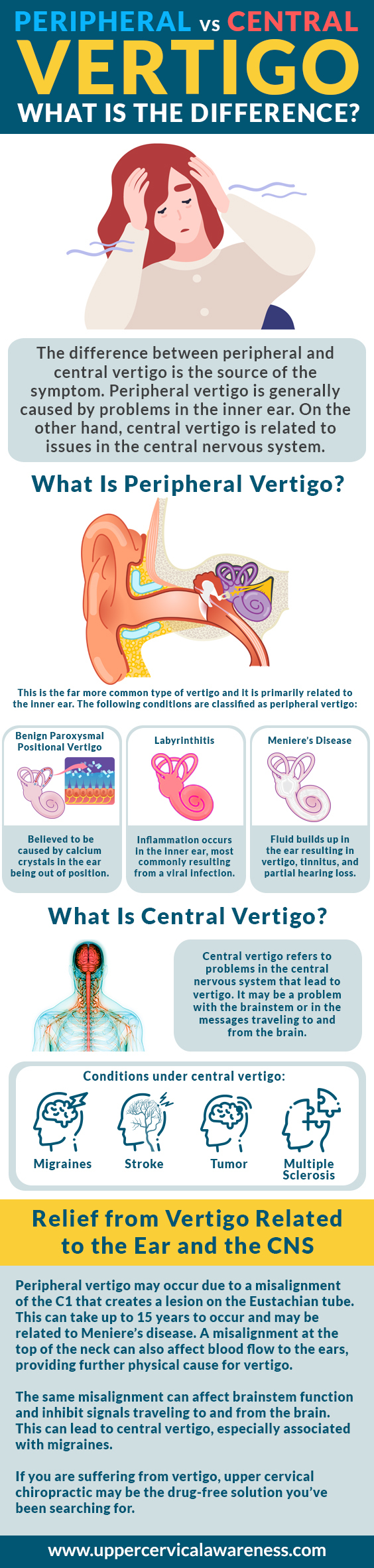 central vertigo, peripheral vertigo